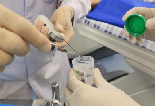 CT引导下经皮肺穿刺活检术取出的标本1